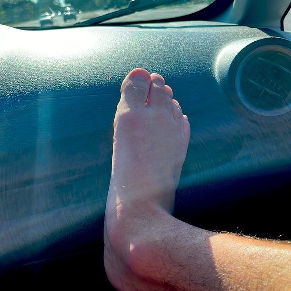 Feet - Picture 1 of 1